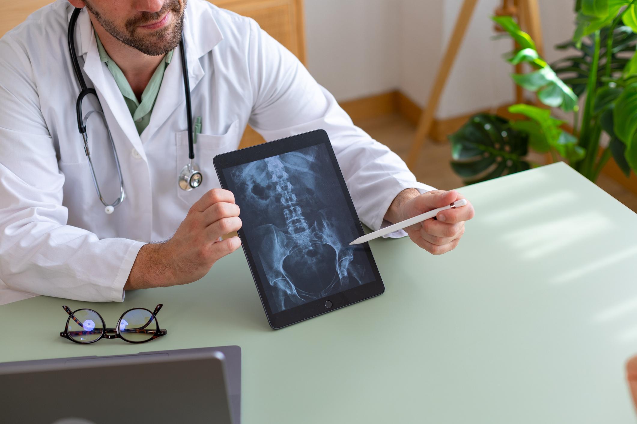 iPad showing a hip xray in doctors hands