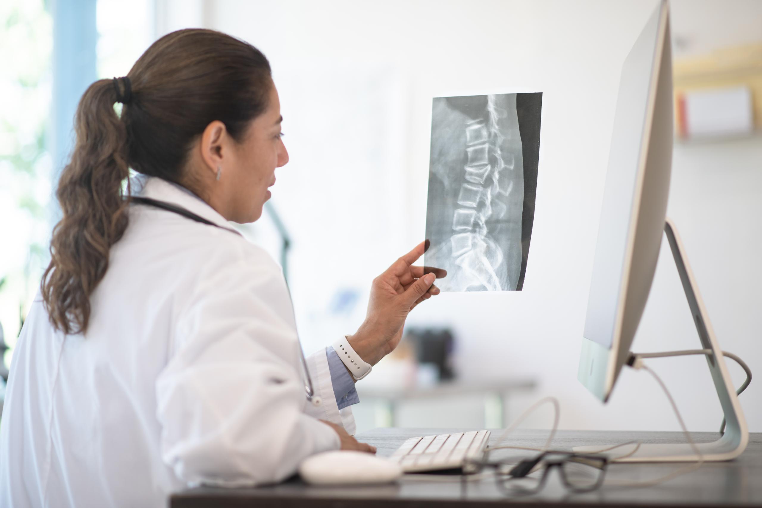 A doctor looking at a scan of a spine