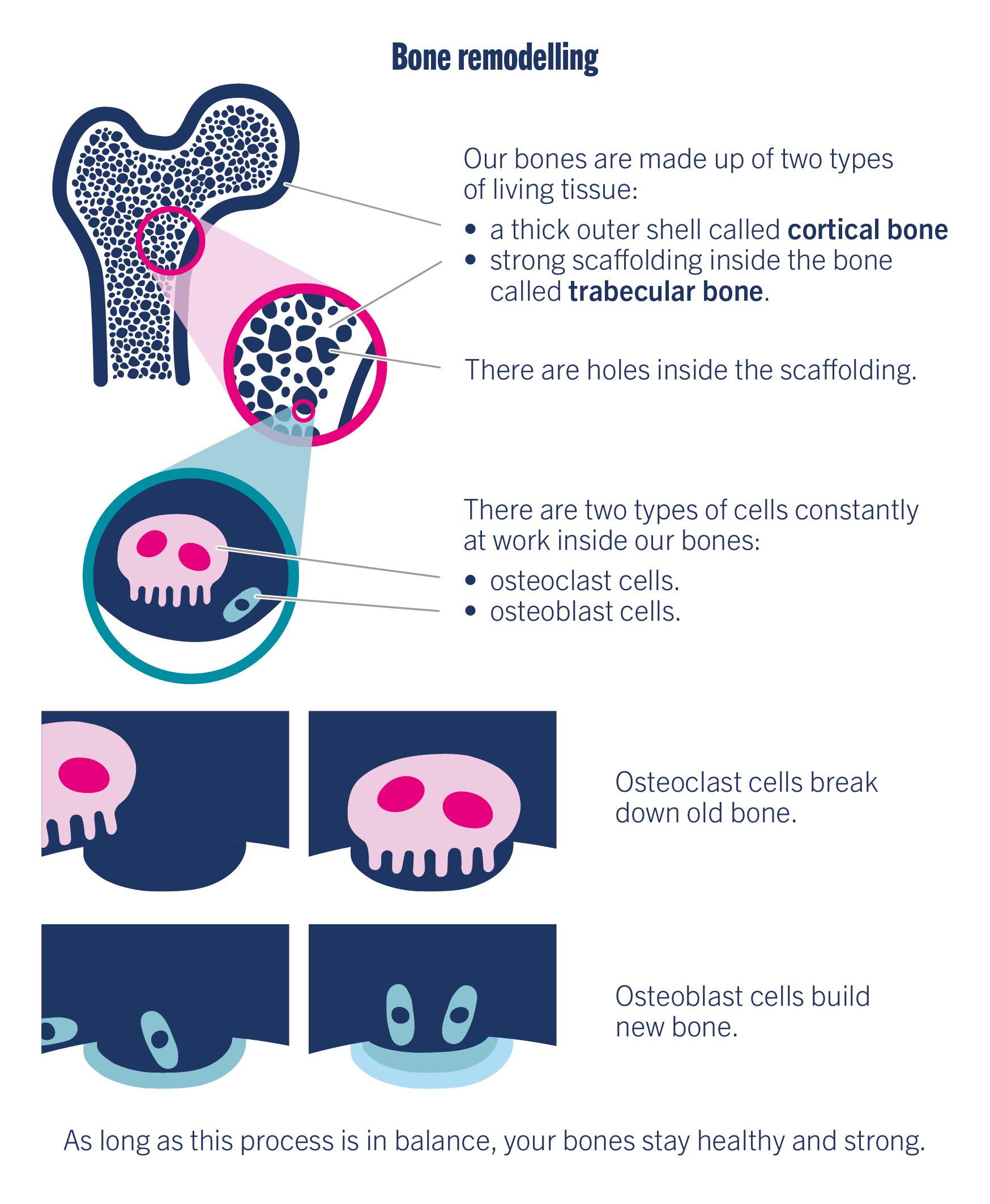 Diagram showing the outer shell of the bone and scaffolding inside the bone, and two types of cells called osteoclast and osteoblast cells.