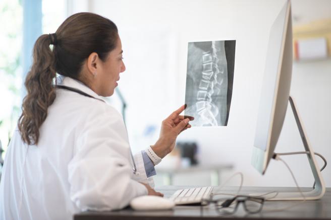 A doctor looking at a scan of a spine