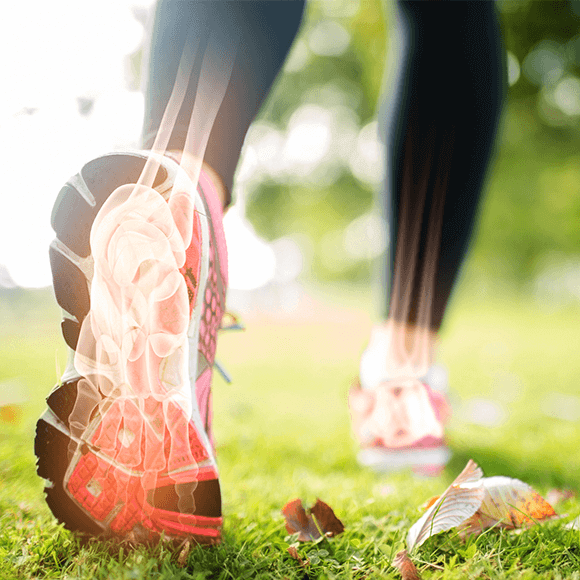 A runner with a xray image of a bone showing through the sole of the shoe