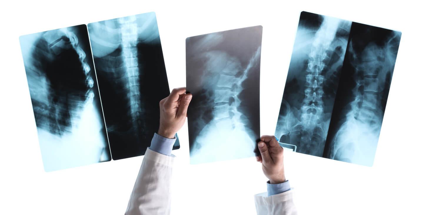 Doctor holding spine scans