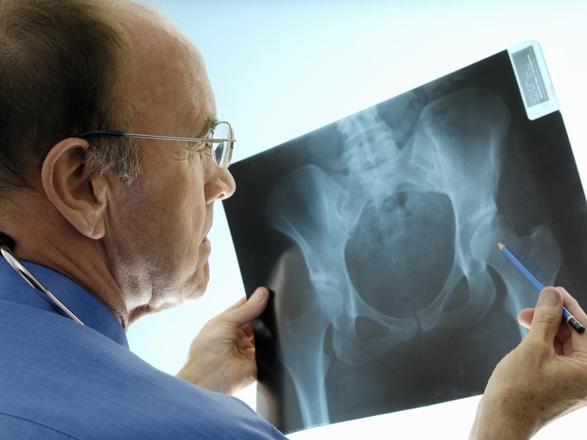 Healthcare professional looking at a scan