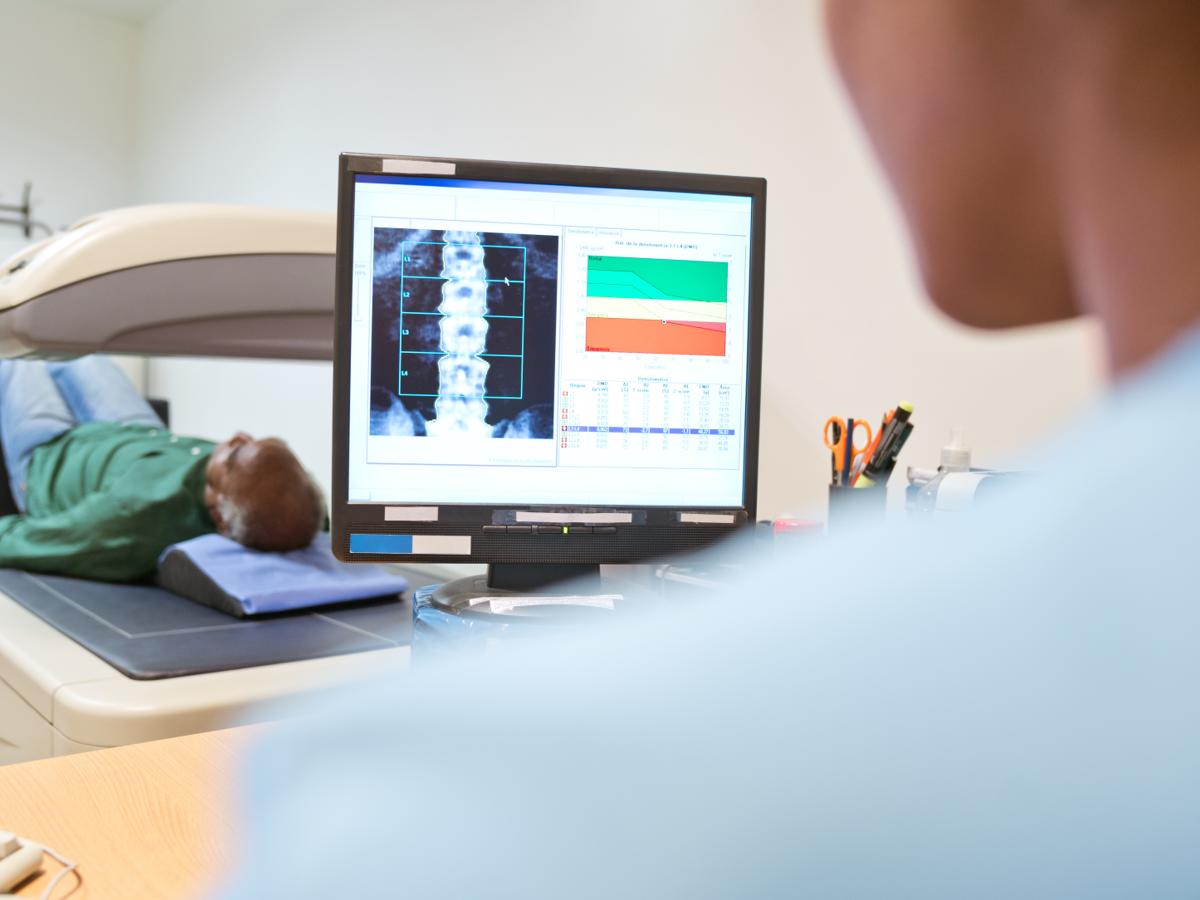A computer showing a scan of a spine