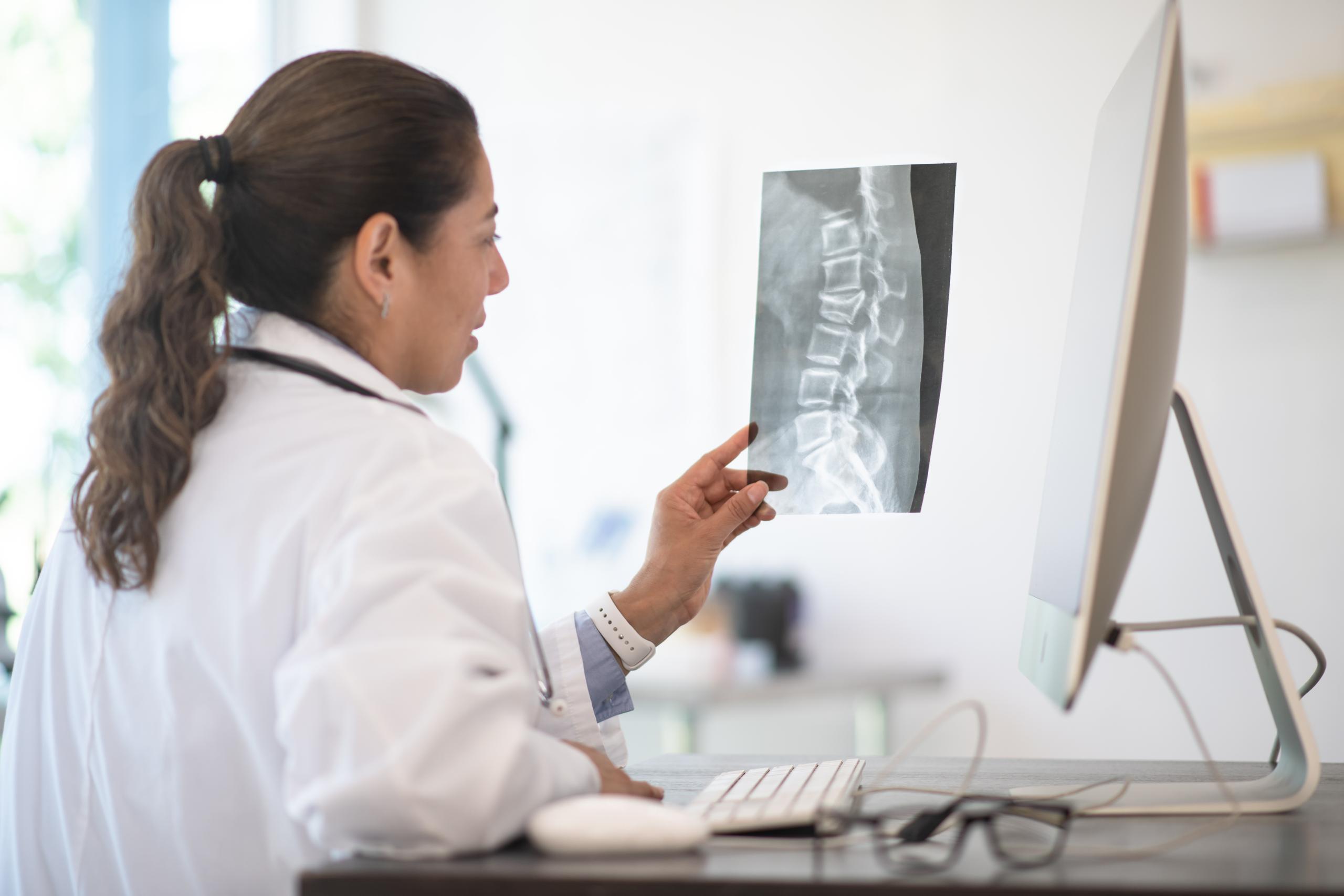 A doctor looking at a scan of a spine