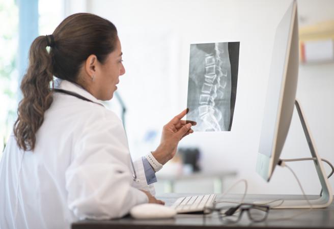 A doctor looking at a scan of a spine